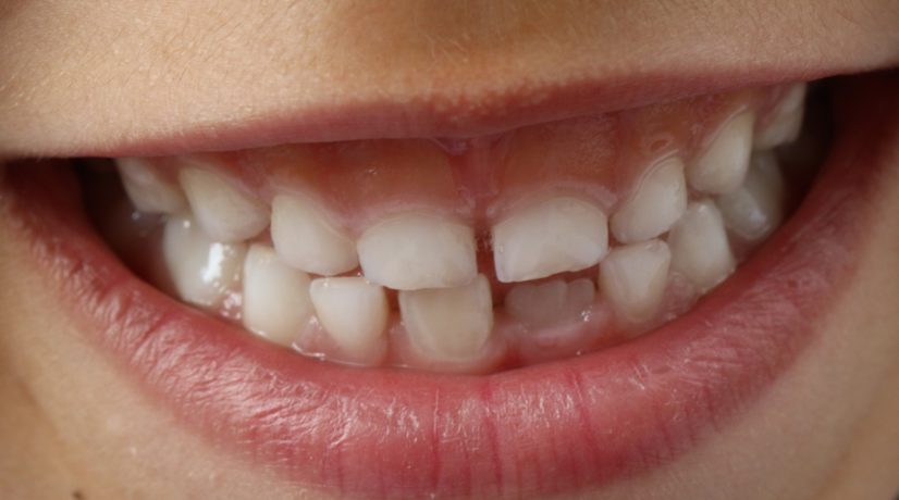 Что нужно знать о детских зубах, — советы стоматолога